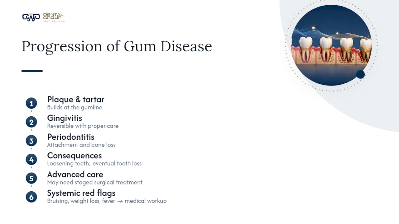 Progression from gingivitis to periodontitis