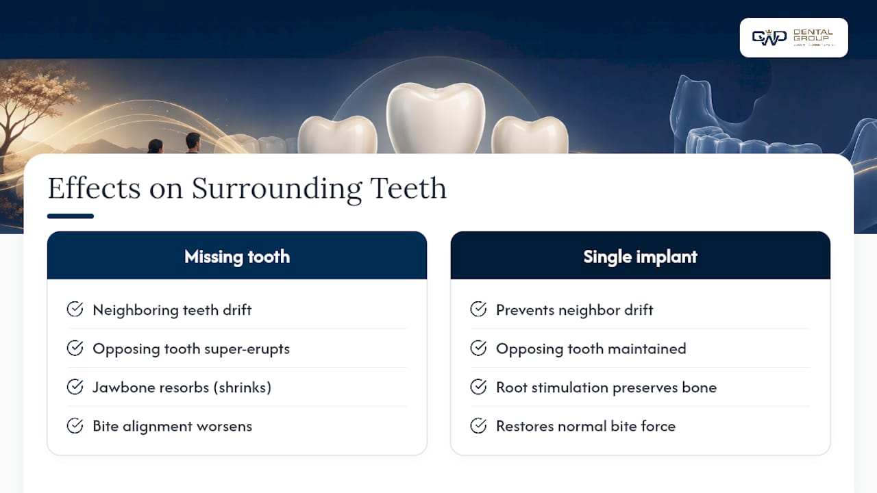 How One Missing Tooth Affects Everything Around It — overview diagram