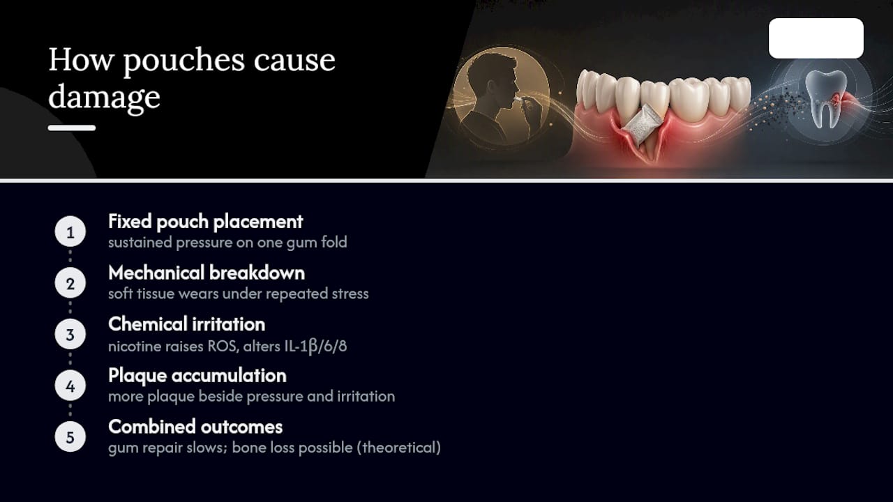Diagram of local pouch-related gum effects