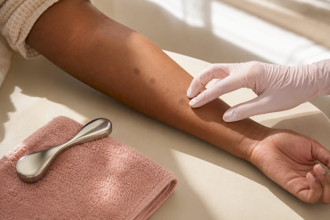 Clinician examining laser test patches