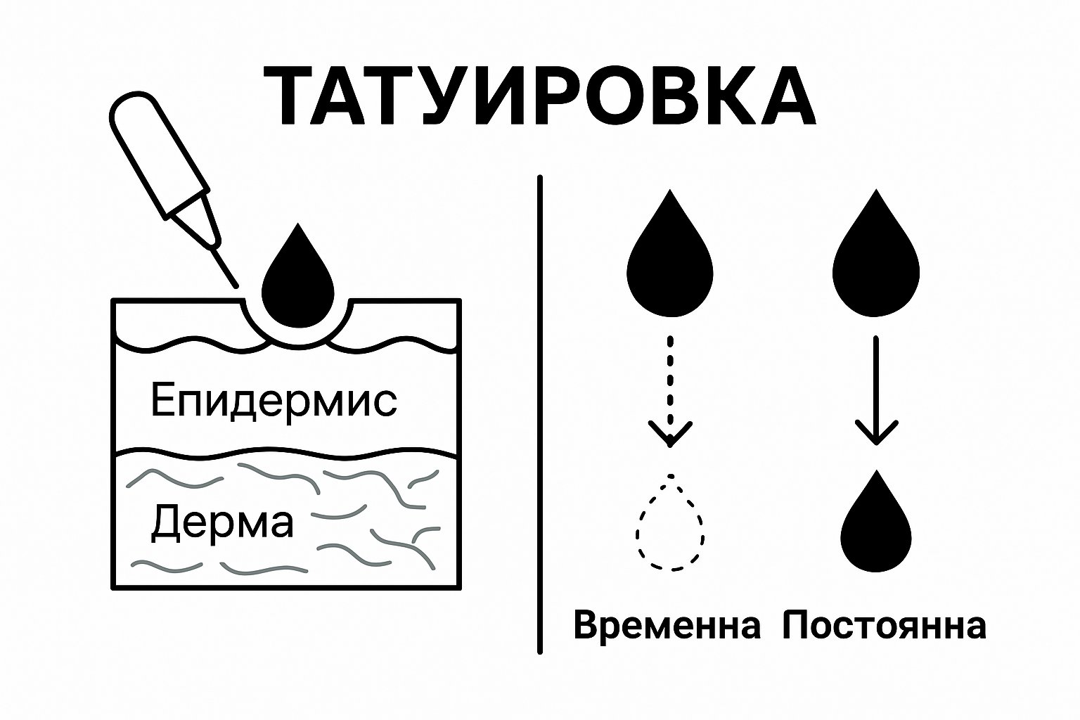 Infographic comparing tattoo ink in epidermis vs dermis skin layers
