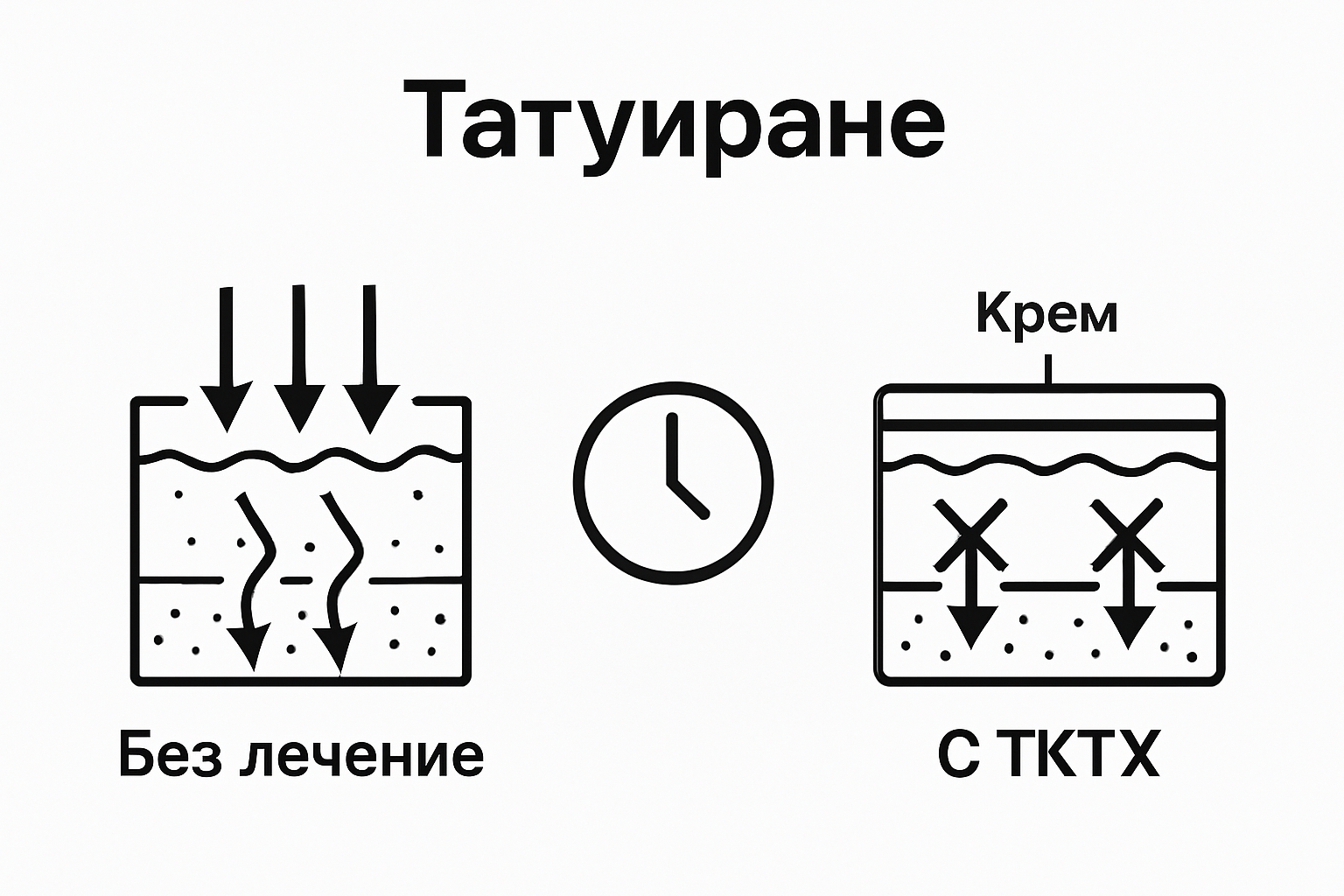 Сравнение между кожа с и без TKTX обезболяване