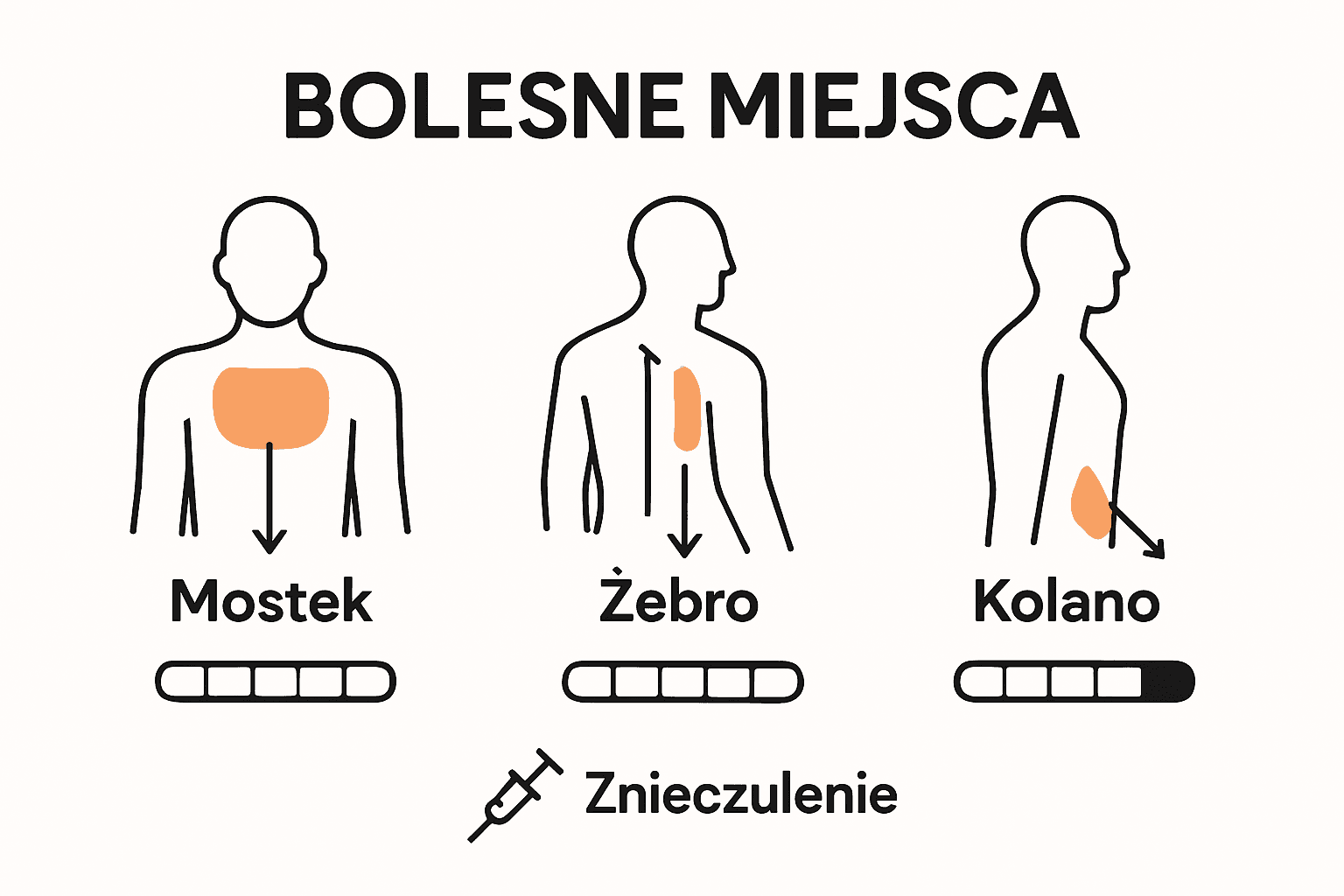 Infografika miejsca bólu a znieczulenie przy tatuażu