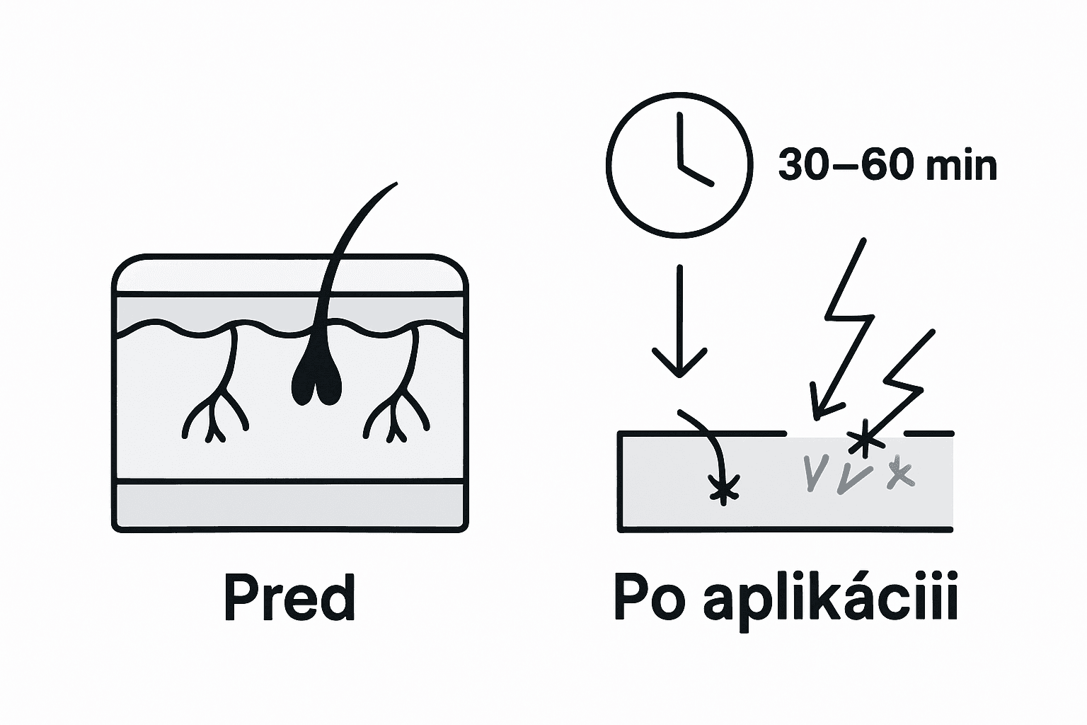 Infografika: Ako funguje znecitlivujúci krém pri tetovaní