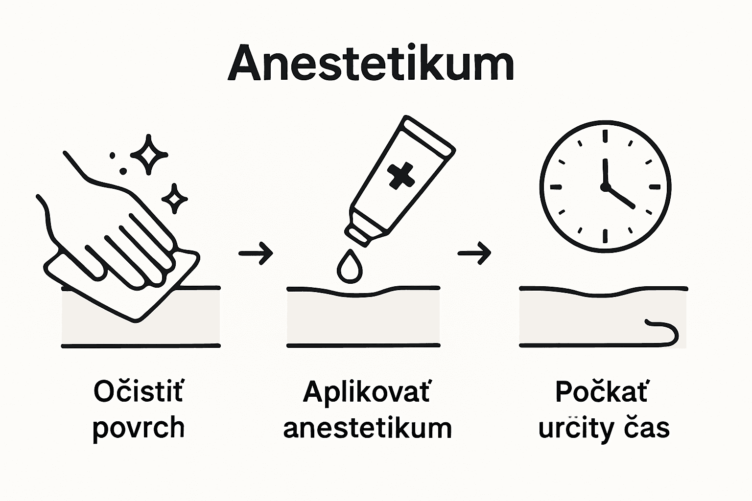 Infografika: postup pri aplikácii anestetika krok za krokom