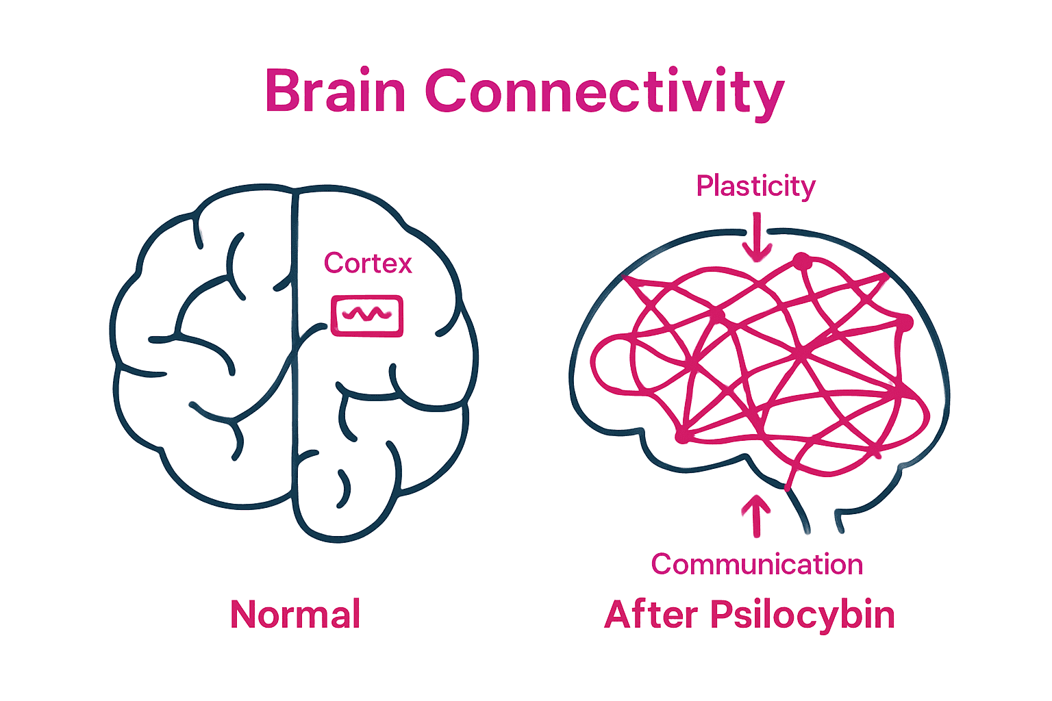 Infographic showing brain network changes before and after psilocybin.