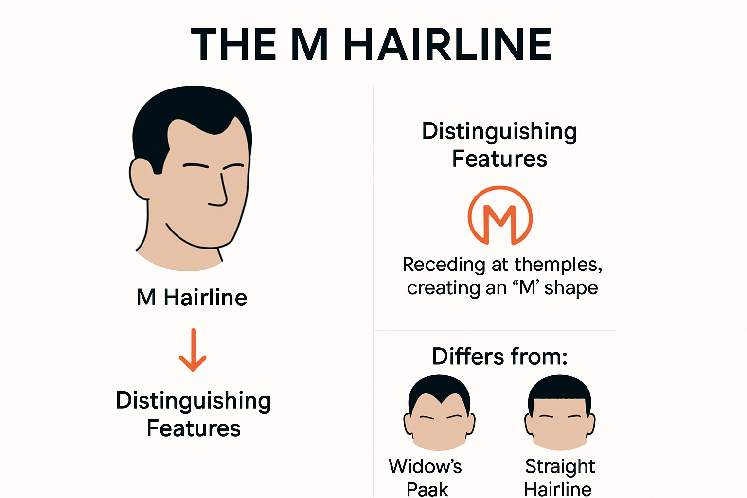 Illustration comparing M hairline with other hairline types