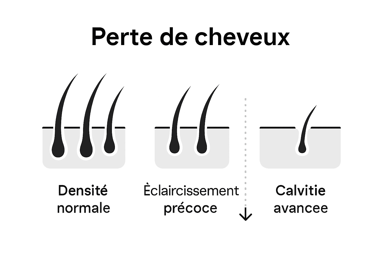 Infographie illustrant les différentes étapes de l’affinement capillaire