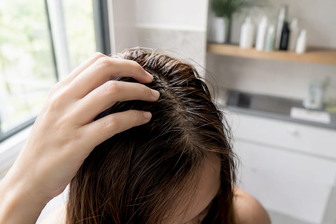 Hand parting oily scalp close-up