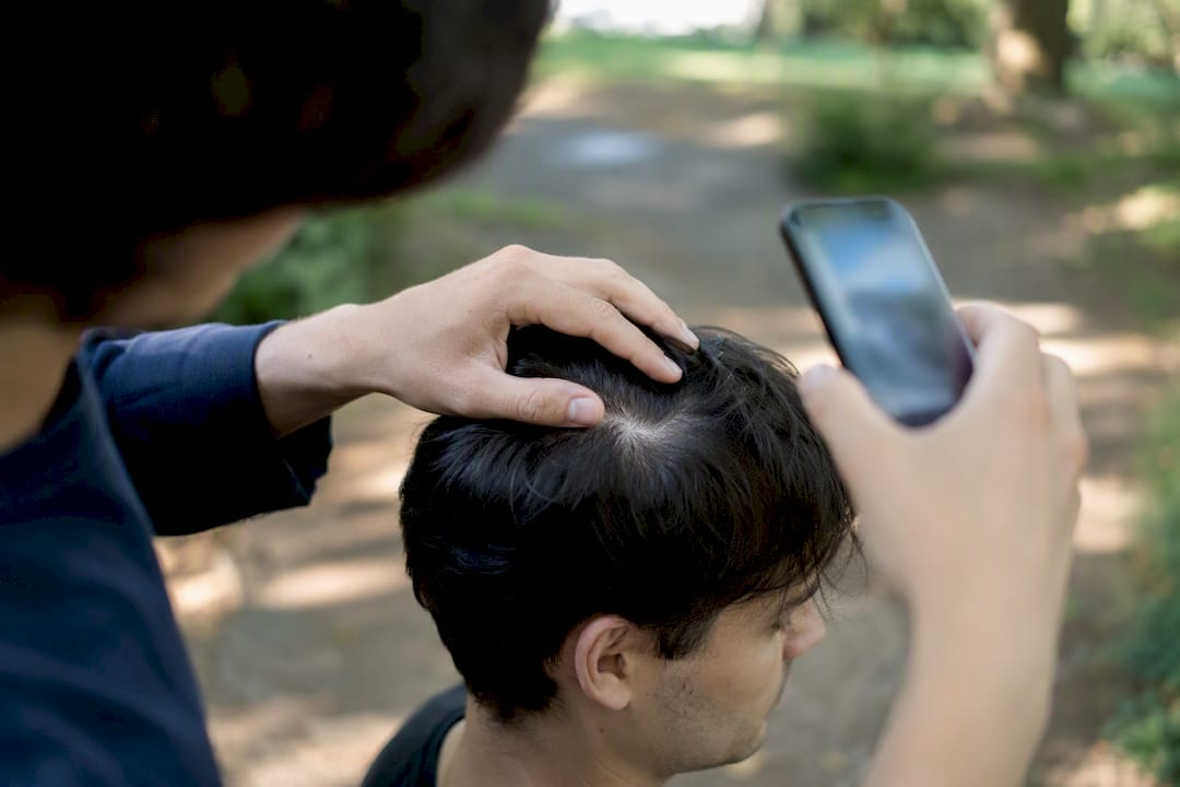 Smartphone scannt die Kopfhaut zur Beurteilung der Haargesundheit