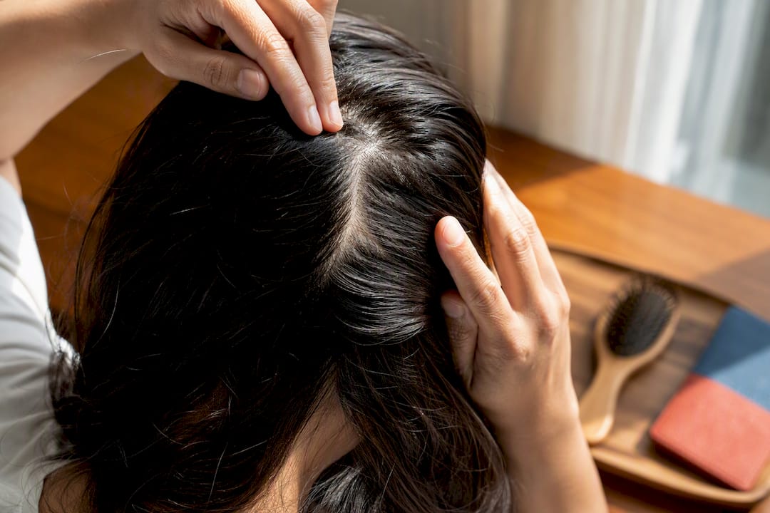 Healthy scalp revealed between parted hair
