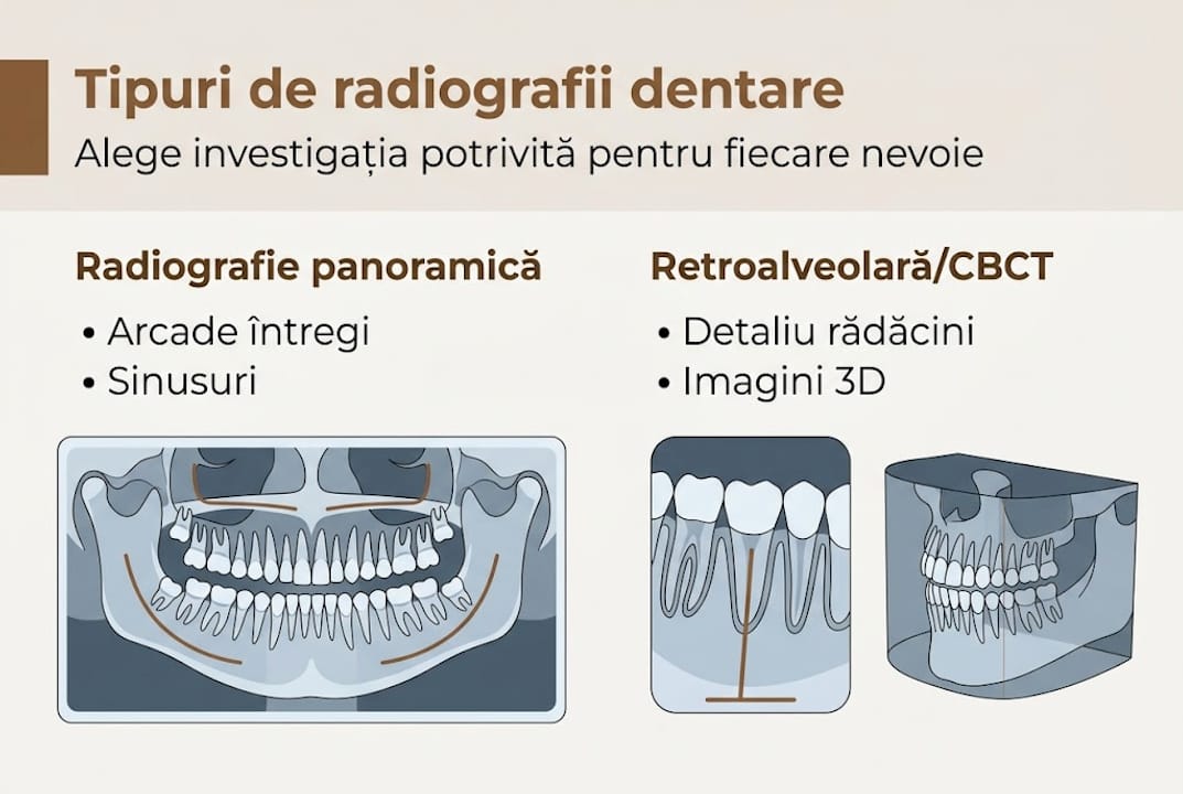 Ghid vizual al principalelor tipuri de radiografii dentare