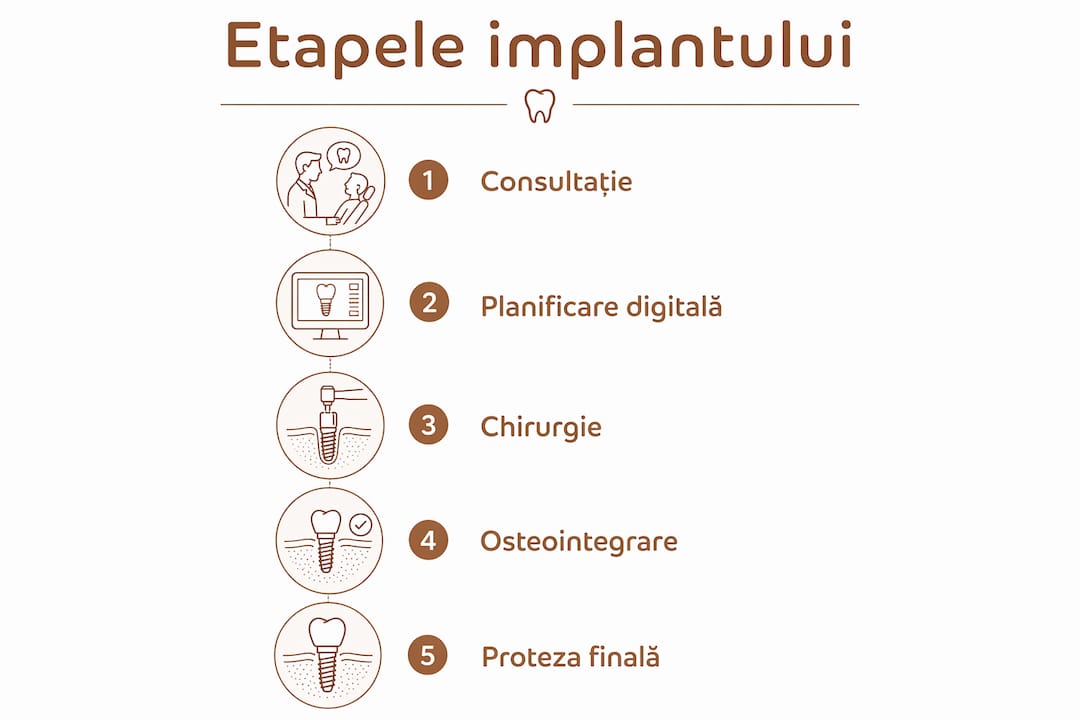 Infografic: pașii esențiali ai procedurii de implant dentar