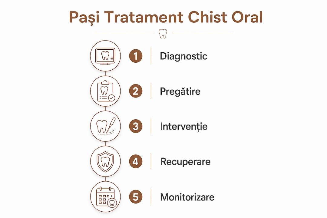 Infografic: pașii esențiali în tratarea chisturilor din cavitatea orală
