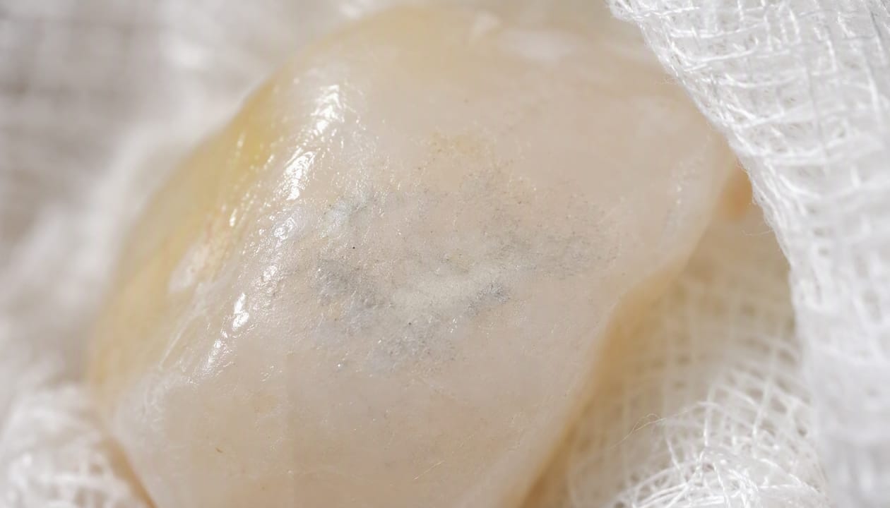 Close-up of rough tooth enamel surface with mineral stains