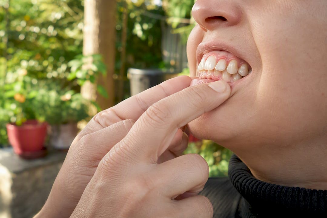 Hand massaging sensitive gums for relief