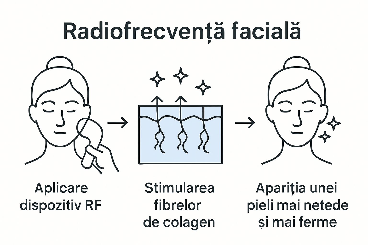 Infografic: etapele tratamentului facial cu radiofrecvență
