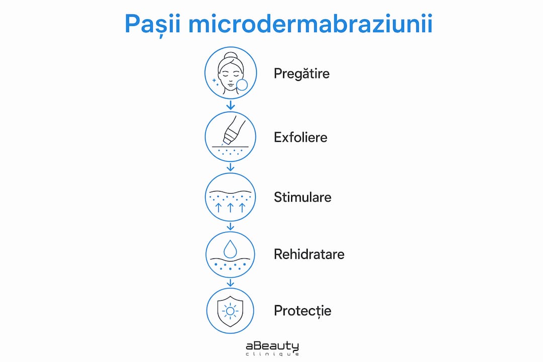 Infografic cu etapele tratamentului de microdermabraziune