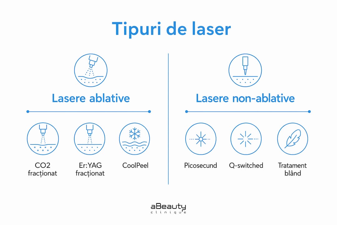 Infografic: Ce tipuri de laser se folosesc pentru întinerirea tenului