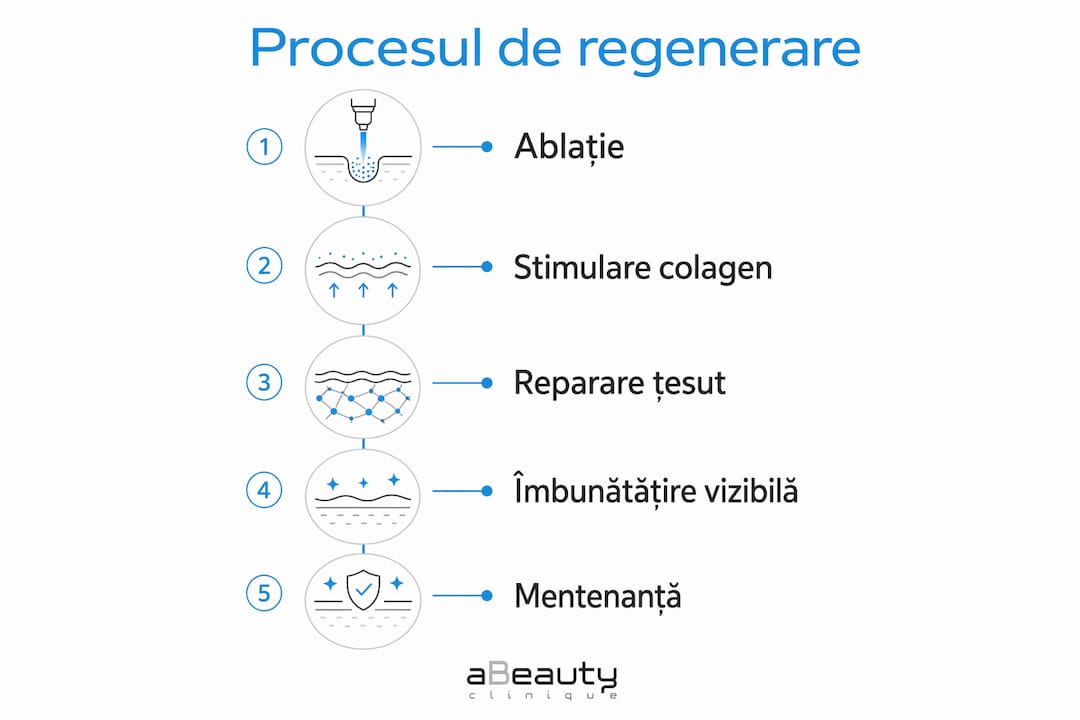 Infografic: Cum se regenerează pielea după tratamentul cu laser CO2