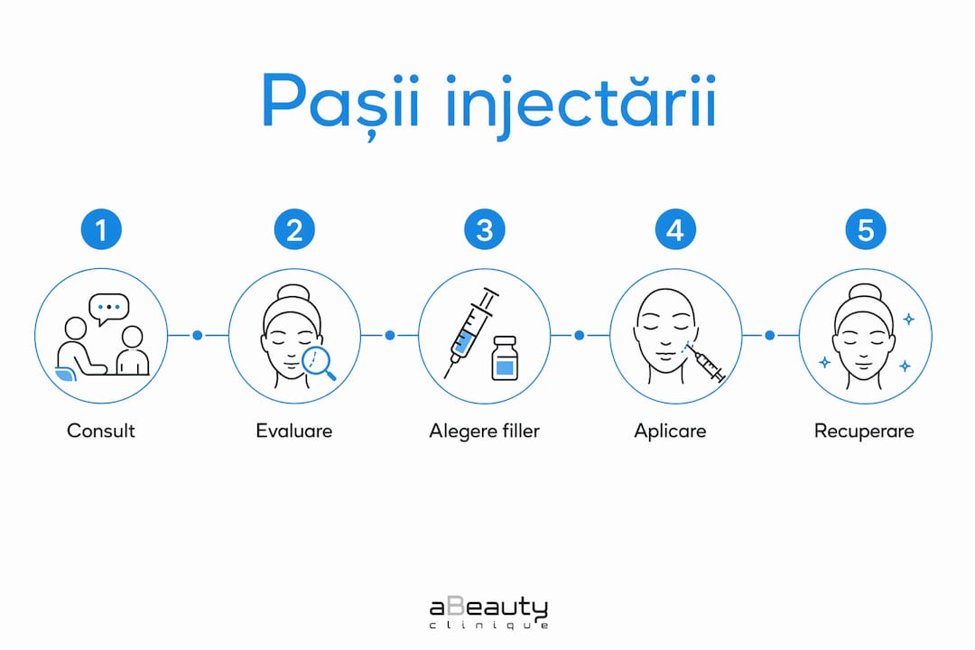 Infografic: etapele esențiale ale injectării cu acid hialuronic