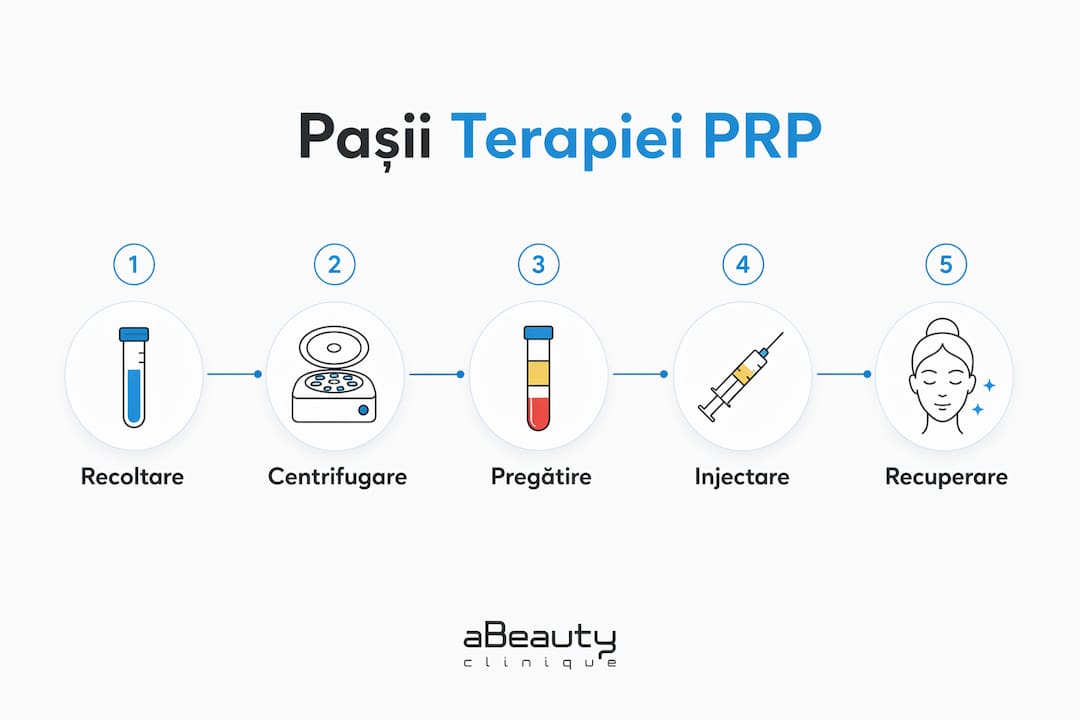 Infografic: etapele tratamentului PRP