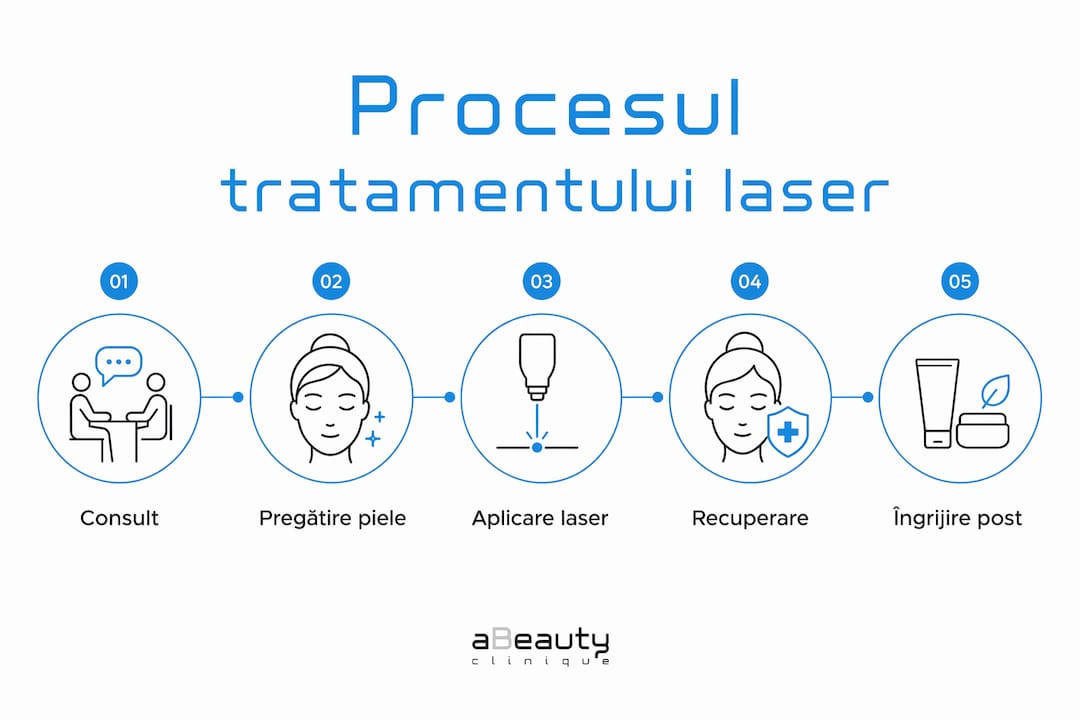 Infografic: etapele principale ale tratamentului facial cu laser