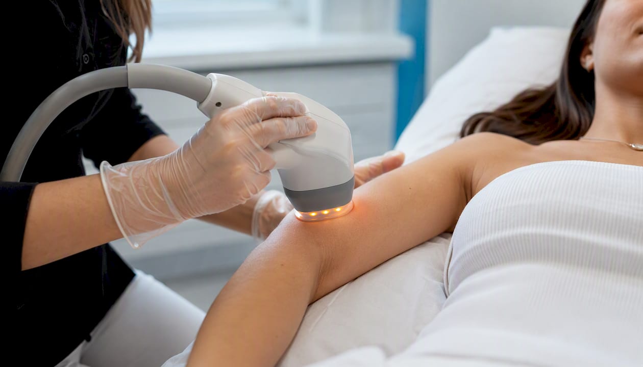 Aparat cu radiofrecvență aplicat pe pielea brațului, surprins în prim-plan