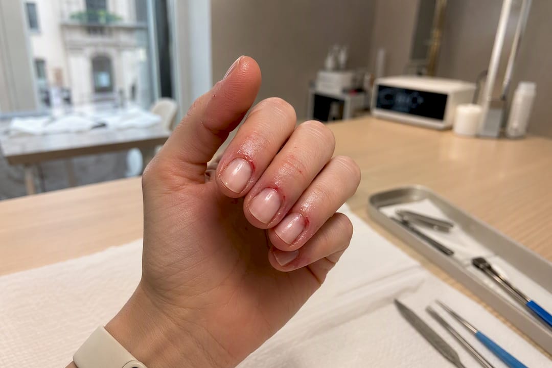 Segni di complicazioni cutanee dopo la manicure