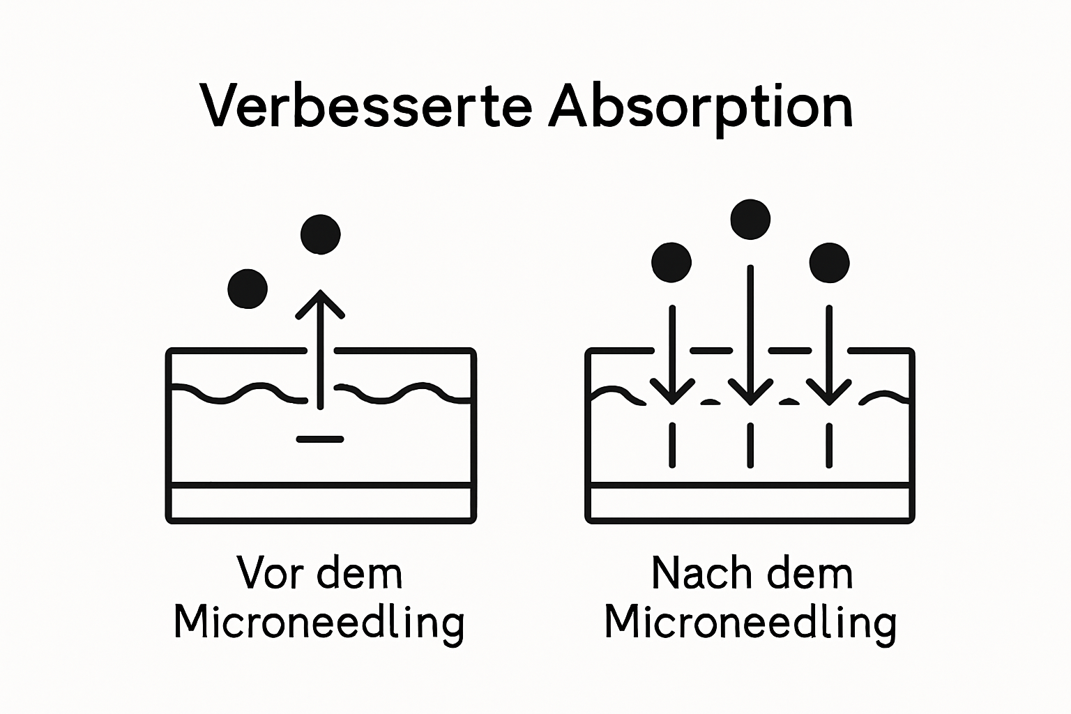 Infografik: Deutlich verbesserte Wirkstoffaufnahme der Haut nach Microneedling