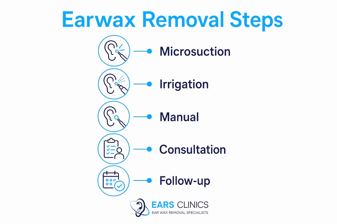 Infographic outlining earwax removal steps