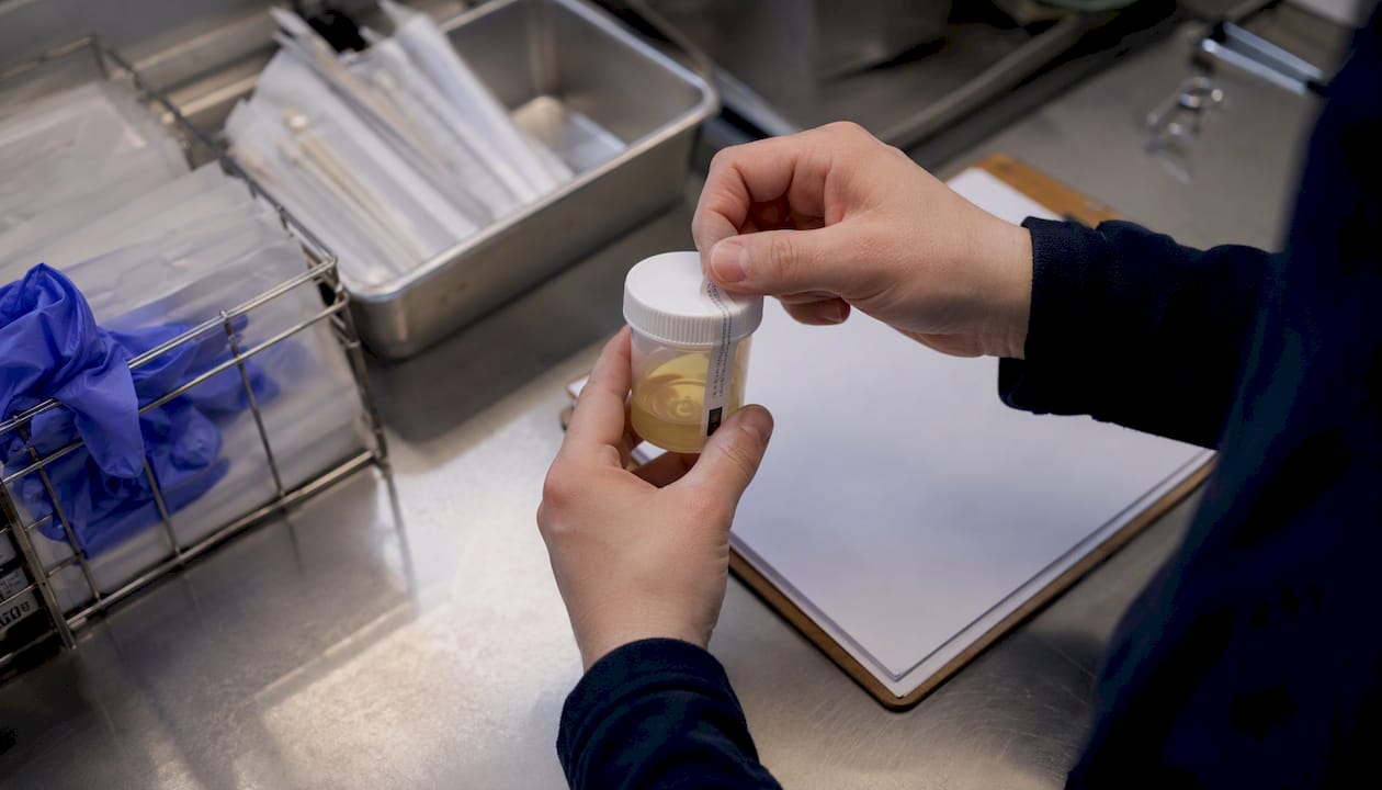 Hands sealing forensic urine drug testing cup