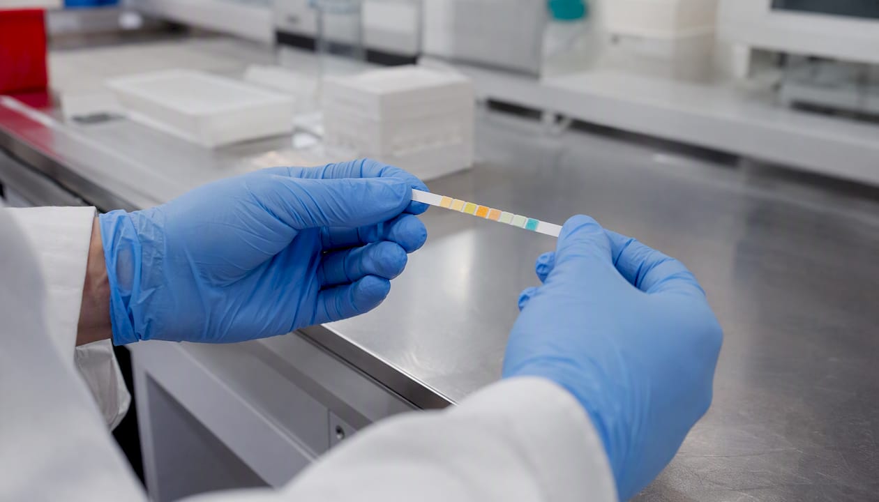 Hands holding urine test dipstick strip