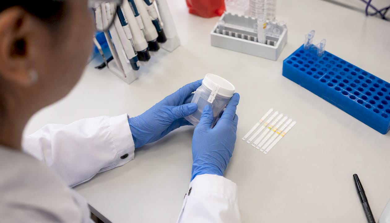 Lab technician handling sealed specimen bottle