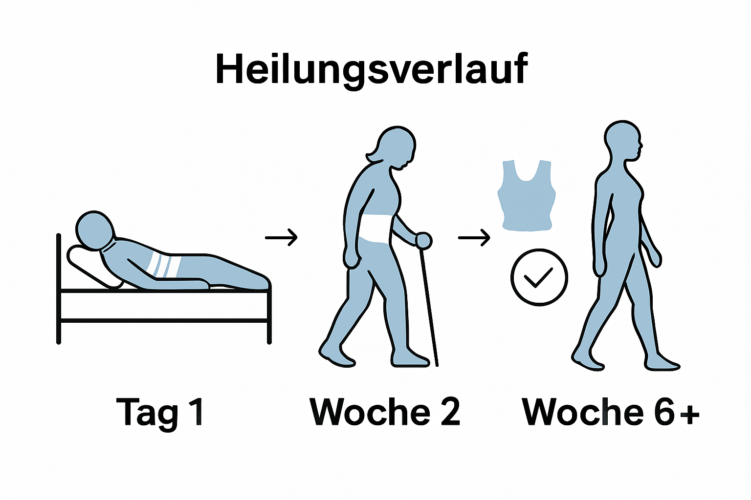 Infografik: Ablauf des Heilungsprozesses Bauchdeckenstraffung