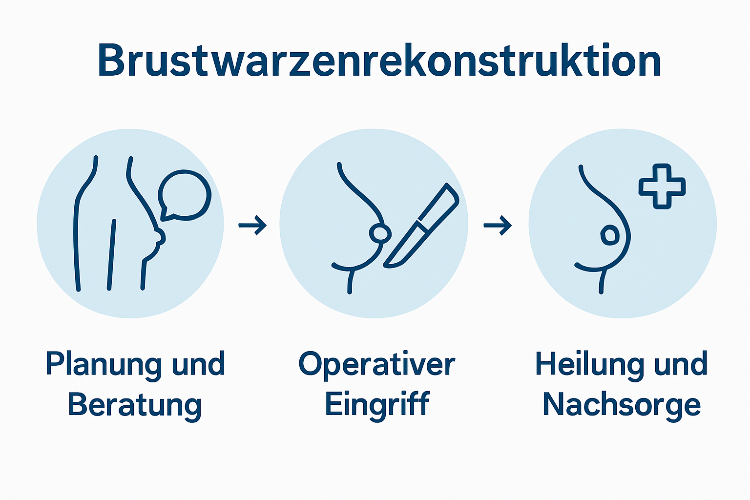 Grafische Übersicht der verschiedenen Phasen einer Brustrekonstruktion