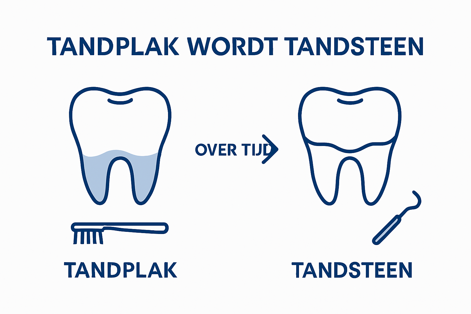 Infographic: het verschil tussen tandplak en tandsteen bij honden